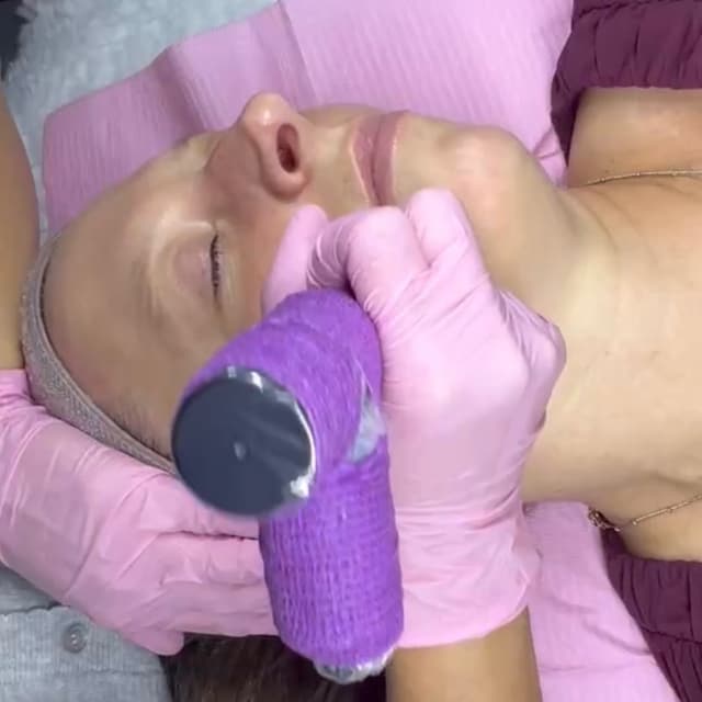 The Texture Transformation Club at The Acne Fairy in Loveland, CO